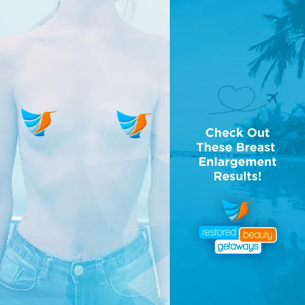 Breast Enlargement – Before & After