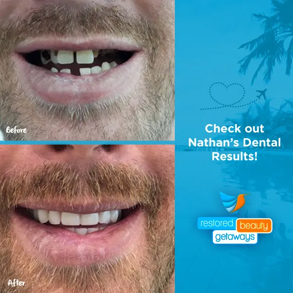 Nathan’s Dental – Before & After