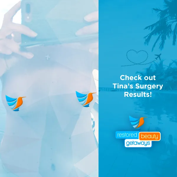 Tina’s Breast Lift & Tummy Tuck – Before & After