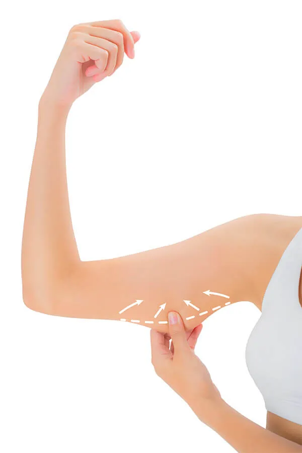 Brachioplasty - Arm Lift Surgery