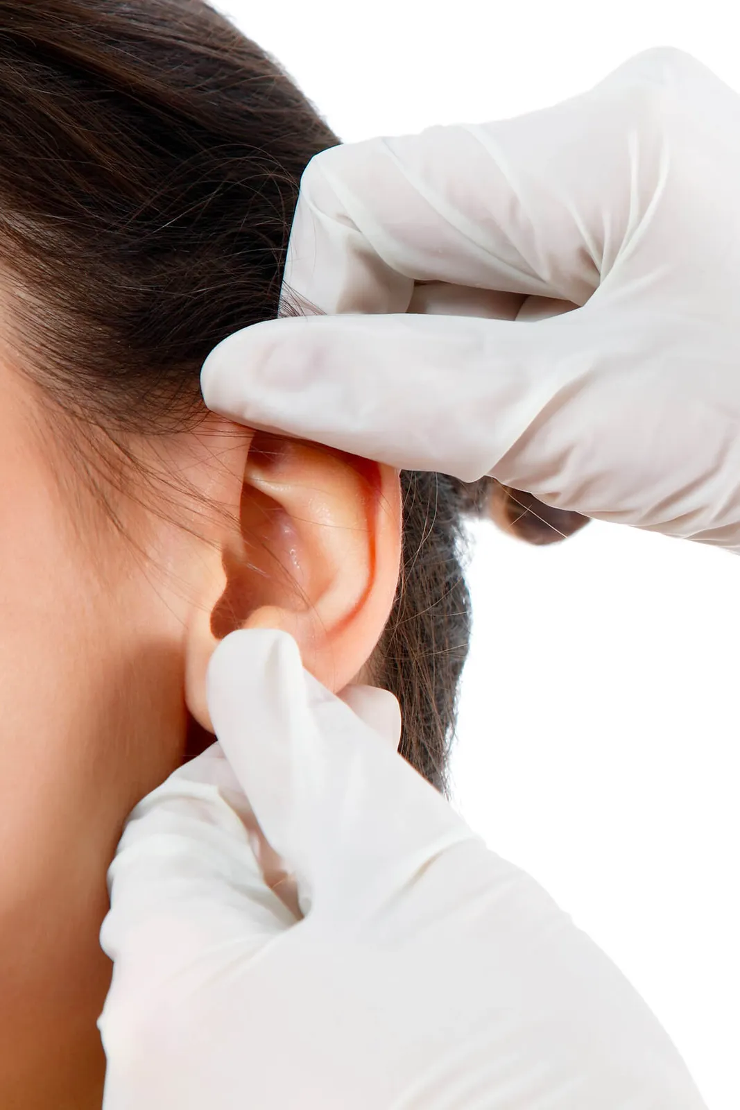 Ear surgery (Otoplasty)