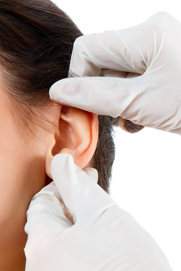Otoplasty - Ear Surgery