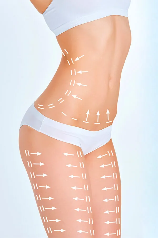 Body Liposuction Surgery