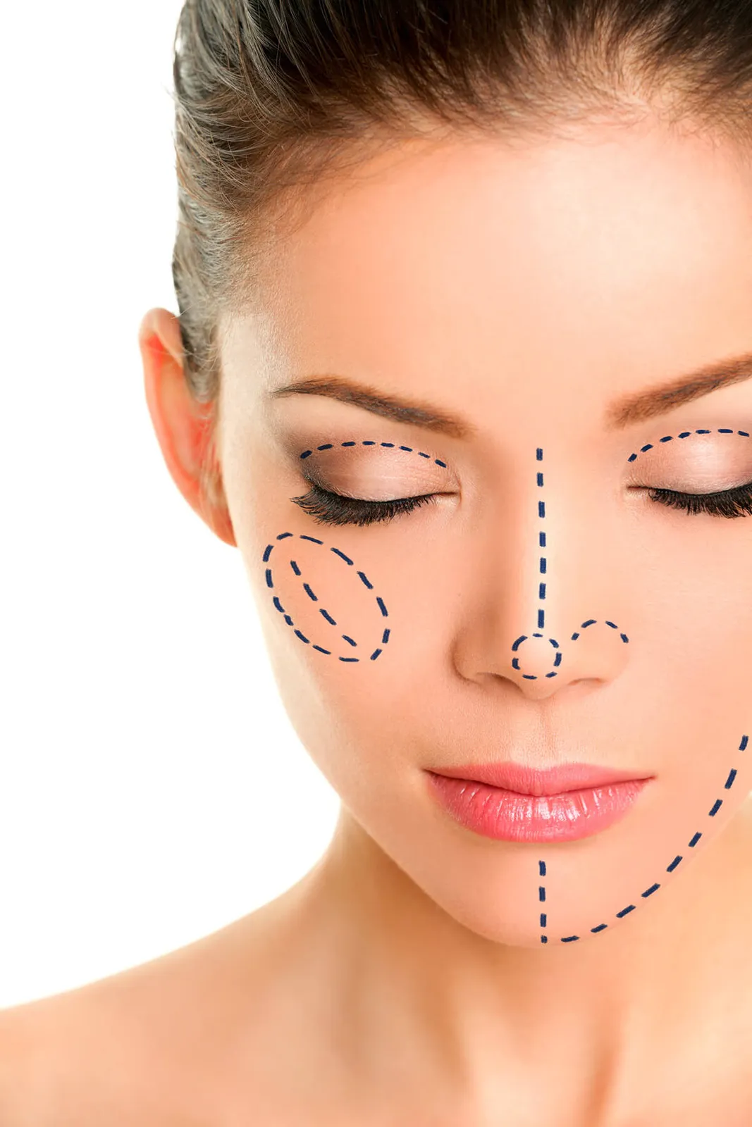 Rhinoplasty (Nose surgery)