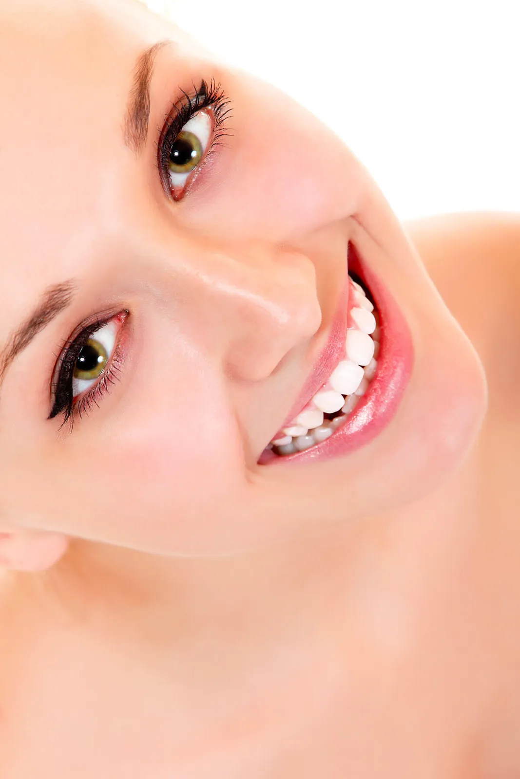 Dental veneers procedure